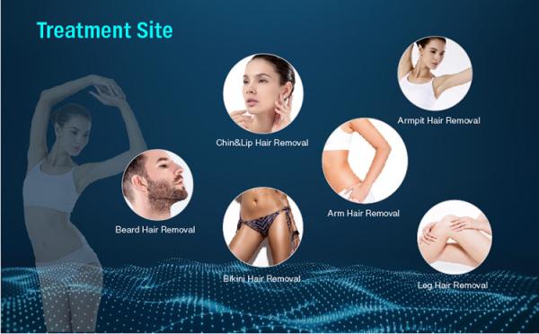 1800W 808nm Diode Laser Hair Removal Machine12 Laser Bar diode ice laser