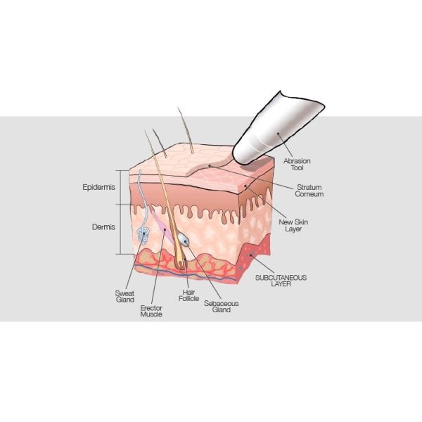 Silk Peel Machine Hydro Dermabrasion Peeling Facial Dermabrasion System