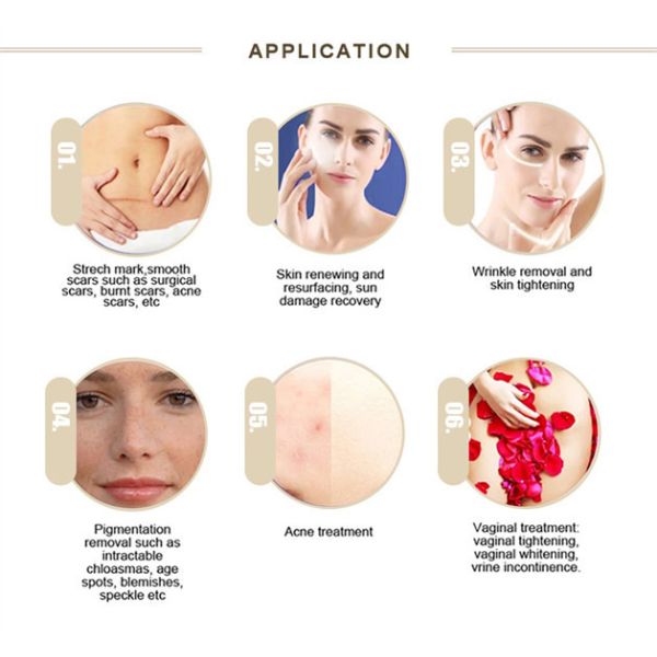 Веснушка извлекая обработку Chloasma оборудования 40W лазера СО2 частичную