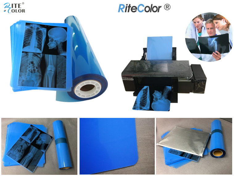 Рентгеновская радиология Платформа медицинского пленки PET для цифровых медицинских изображений