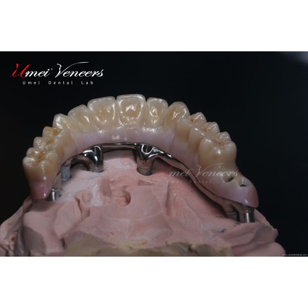 Biocompatible zirconia bridges