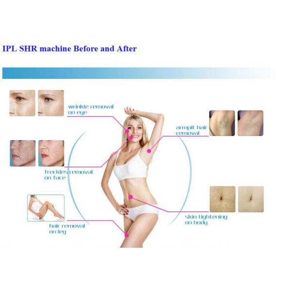Vertical OPT SHR IPL Hair Removal Machine / Skin Rejuvenation Equipment