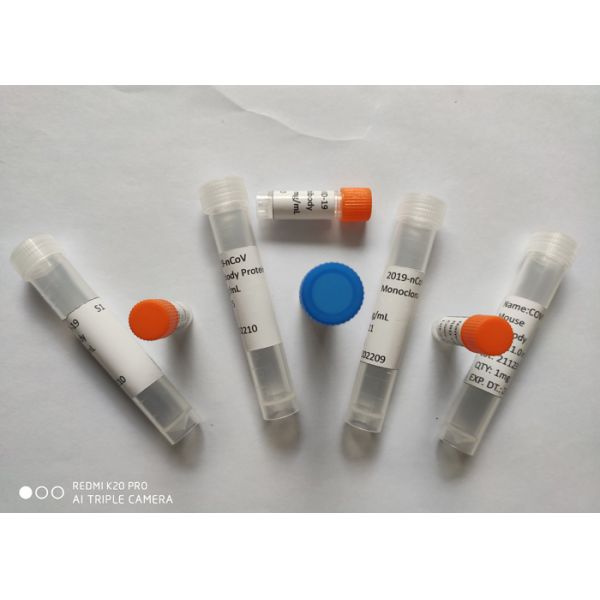 Протеин шипа SARS-CoV-2/2019-NCoV S2 ECD моноклонального антитела рекомбинатной мыши