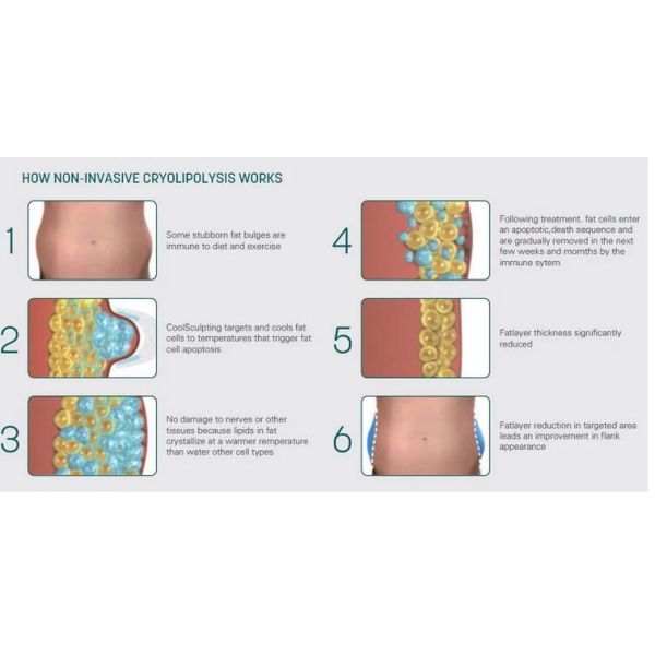 Vertical Model Body Slimming Machine 4 Handles Working Simultaneously