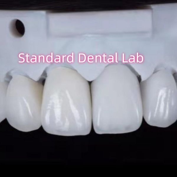 Естественный вид реставрации зубной цирконии зубной короны