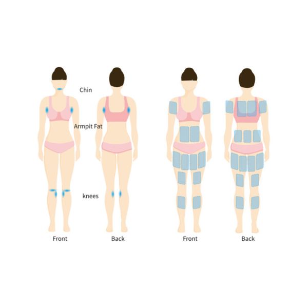 360° Criolipólisis congelación de grasa CoolSculpting cuerpo adelgazamiento máquina de pérdida de peso