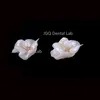 Digital Empress Onlay And Inlay Customized By Dental Prosthesis Laboratory