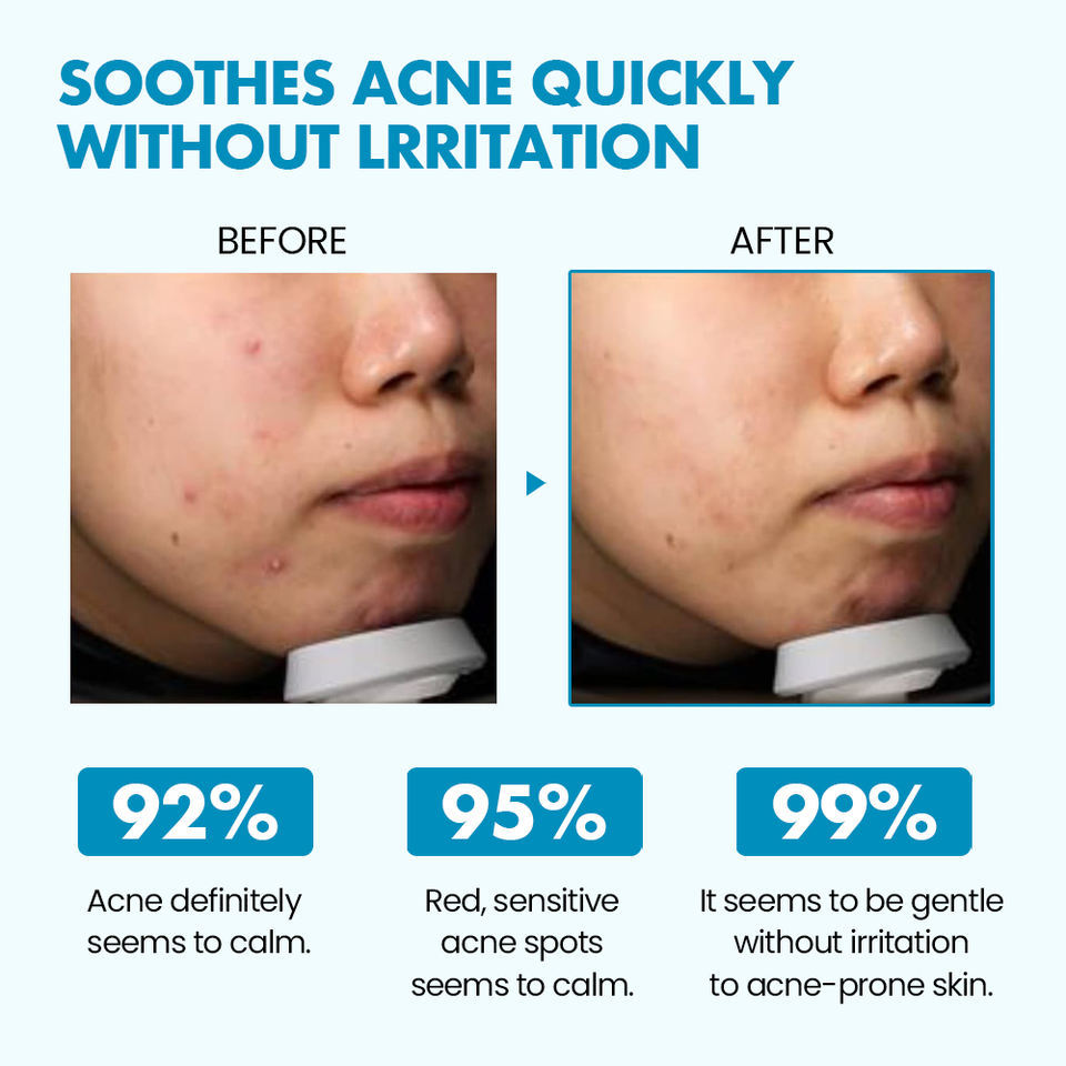 OEM ODM Brand Skin Care Toner Glycolic Acid Whitening Acne Removing Skin Toner spray