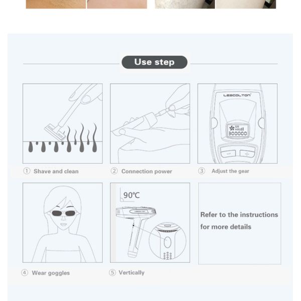 Portable Home Laser Hair Removal Machine With 100000 Pulse Tender Skin