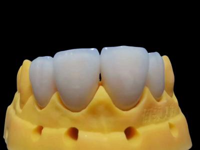 Tear Resistant Fitting Full Zirconia Crown Customizable Safe To Use