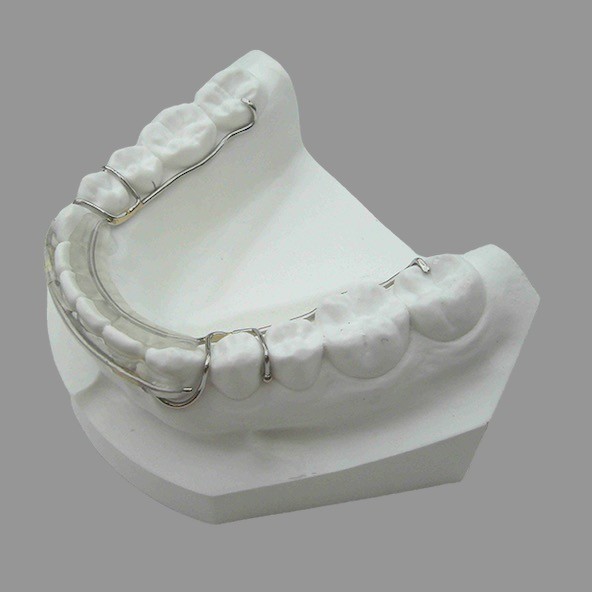 Dental Laboratory China | Oral Health Removable Wire Retainer Customizable For