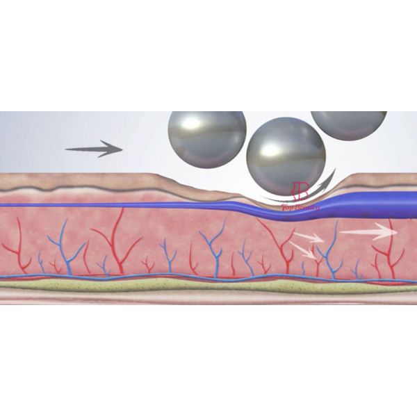 Обработка R6  машины уменьшения целлюлита формы тела