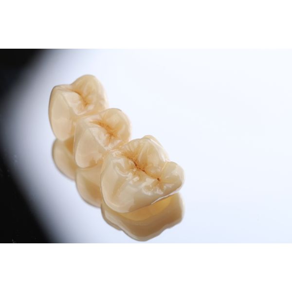 16 Colors Zirconium Oxide Ceramic Top Translucent 1100Mpa Strength