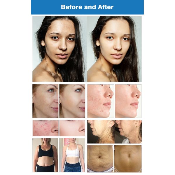 4 en 1 EMS máquina de onda de choque 448K máquina de terapia de vacío para dar forma al cuerpo