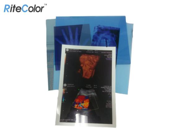 Filme seco da imagem latente médica de Digitas para o filme médico azul 210mic do Inkjet do ANIMAL DE ESTIMAÇÃO de X Ray