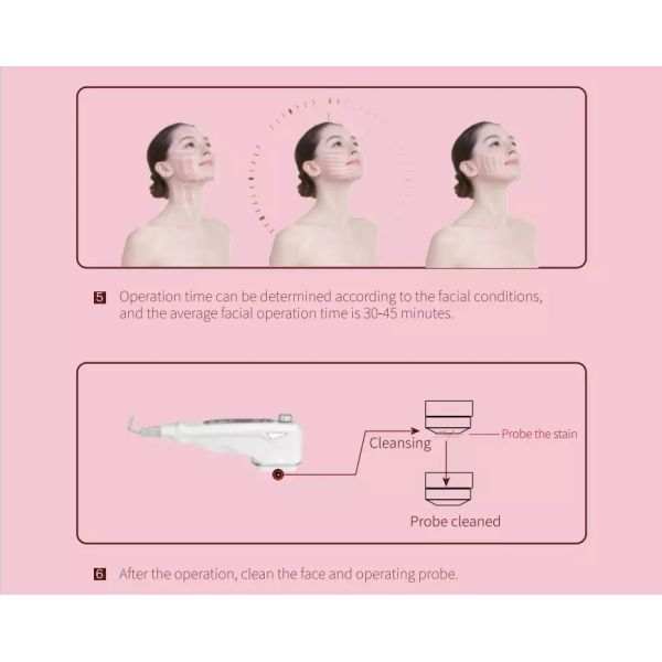 lf-424 Home use hifu machine mini hifu 0 consumables and no need to replace cartridge