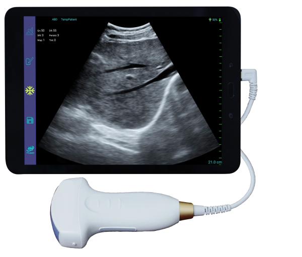Hot Sale Smart USB Convex Medical Doppler Ultrasound Scanner Ultrasound Probe