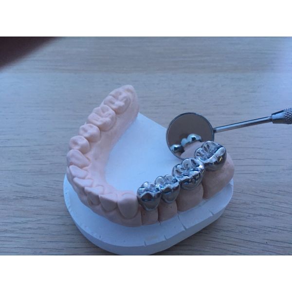 Larynx Examination Dental Clinic Instruments #4 Head Only Magnifying Type