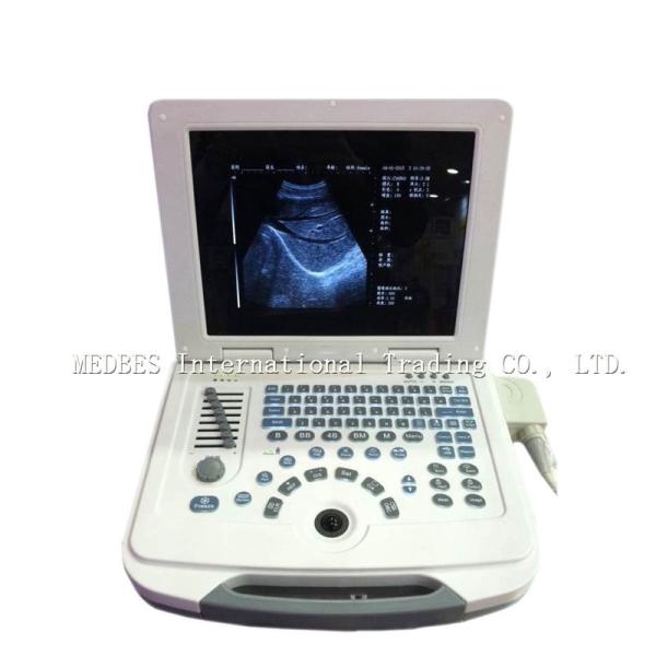 Clinic Hospital  Obstetrics and Gynecology Department Laptop Ultrasound Machine with Battery