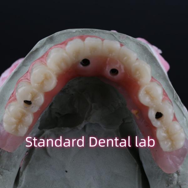 Porcelain Zirconia Dental Implant Bridge Professional High Esthetics With Pink Gum