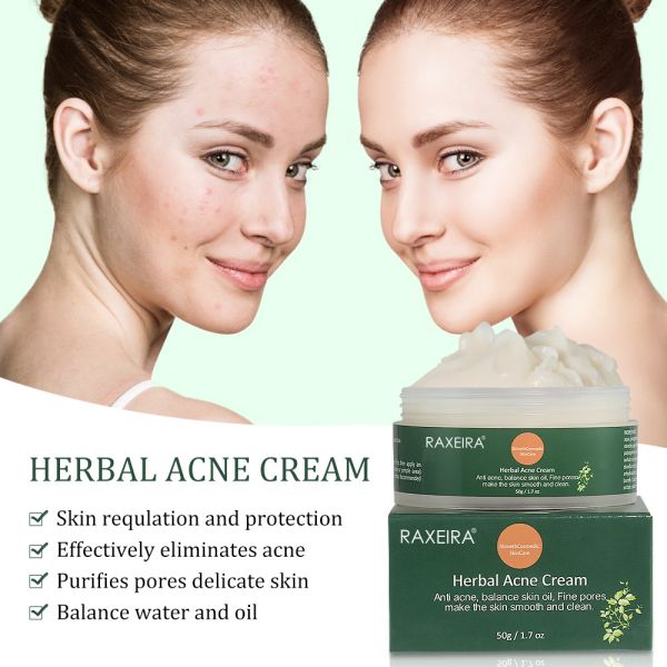 Herbal Anti Acne Cream Scar Remove Treatment Cleansing Face Cream