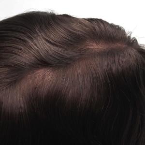 Medium Brown French Lace Stock Hair System 9x11 Heavy Density Hair Replacement