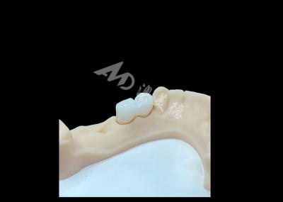Coroa de zircônio sólido de alta qualidade para restaurações dentárias satisfatórias