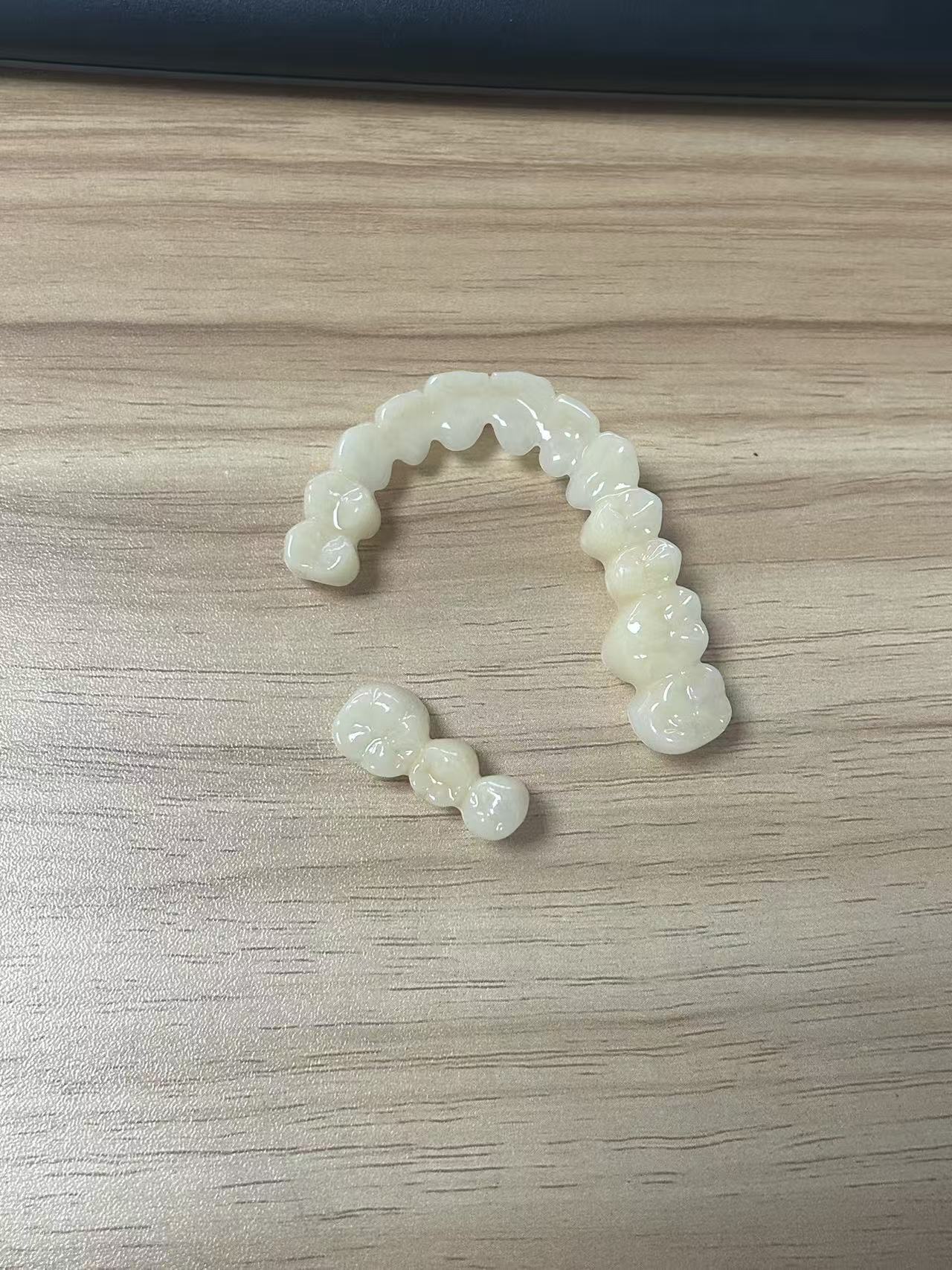 Custom CAD/CAM Digital Design Temporary Teeth with Natural Appearance and Comfortable Fit for Dental Restoration