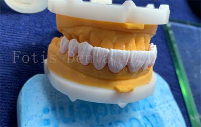 Advanced Digital Dental Crowns Implant Dentrue Crown FDA/ISO/CE Certified