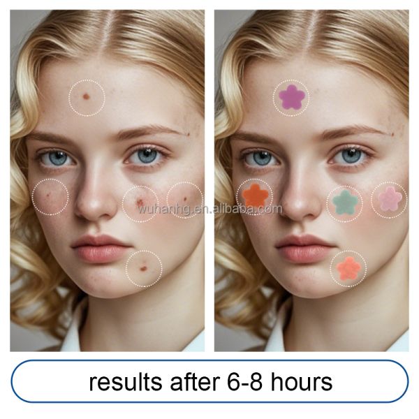 Lovely Flower Hydrocolloid Acne Sticker For Acne Recovery Treatment Custom Color