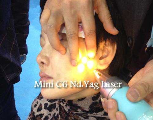 High Peak Power Pico Laser Machine Q Switch ND YAG Laser Machine For Tattoo / Hair Removal