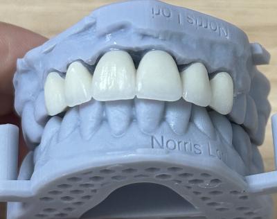 Full Zirconia