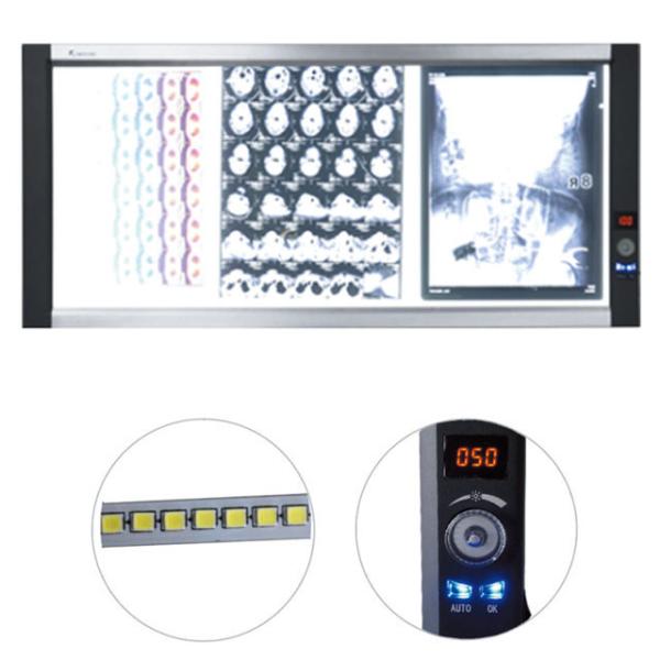 LED x-ray film viewerled medical film viewer