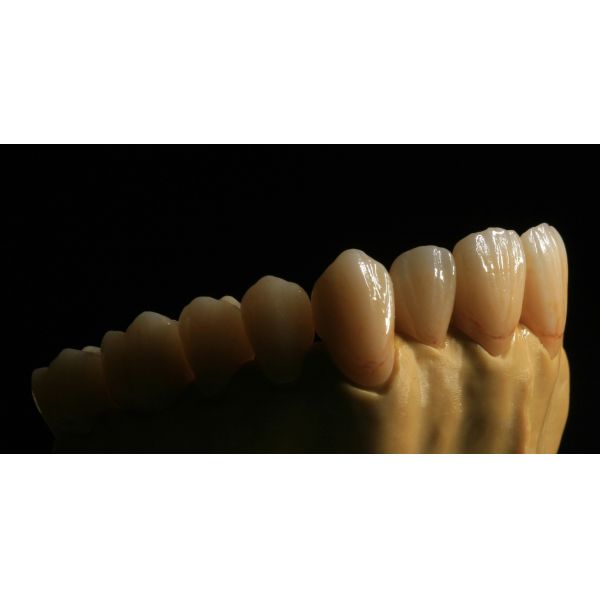Dental Lab Fixed Prosthetics Layered Zirconia Dental Crown For Front Teeth