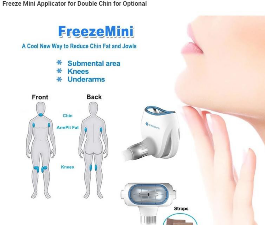 5MHz RF Cavitation 360 Degree Cryo Weight Loss Machine