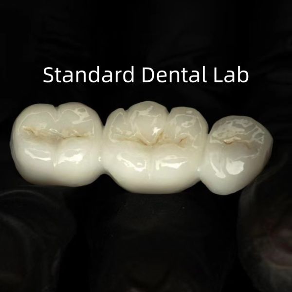 Full Contour High Translucency Solid Zirconia