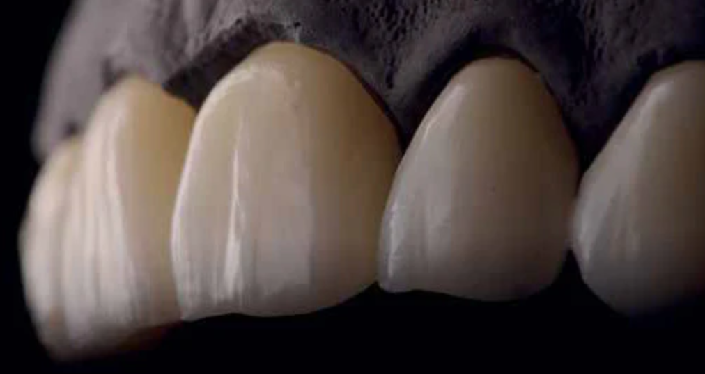 Ceramic 3D Multilayer Zirconia Block 1050 Mpa Classic VITA 16 Shades