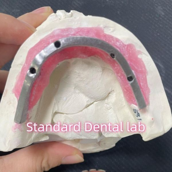Эстетическая реставрация Все на 4 зубных имплантатах Циркония Гипоаллергенная
