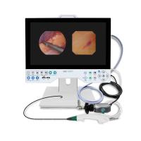 Bonne qualité 1080P 15.6 pouces équipement d'endoscopie médicale système d'imagerie rigide et flexible laryngoscope