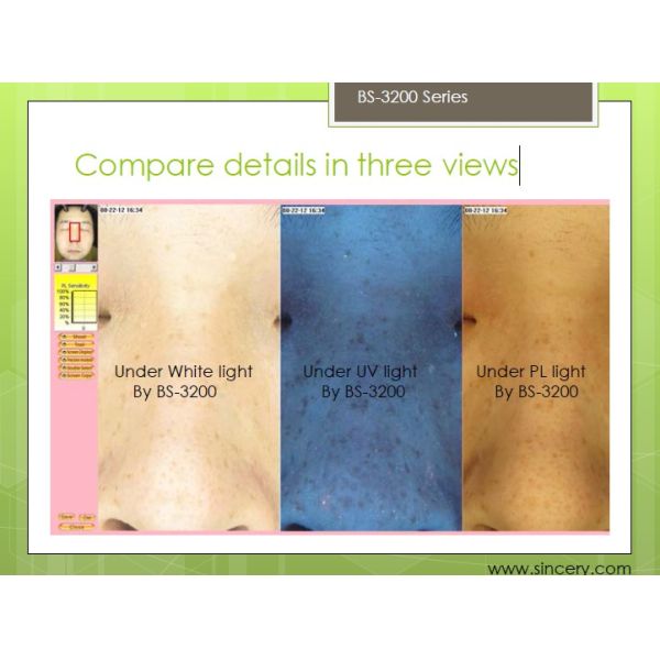 UV RGB Light Facial Skin Analysis BS-3200 Skin Analyzer