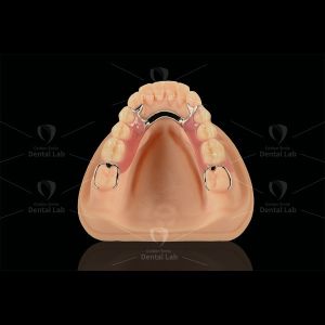 Biocompatible Printed Partial Framework Co-Cr & Acrylic Partial Denture