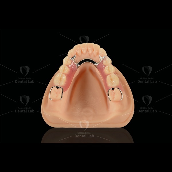 Biocompatible Printed Partial Framework Co-Cr & Acrylic Partial Denture