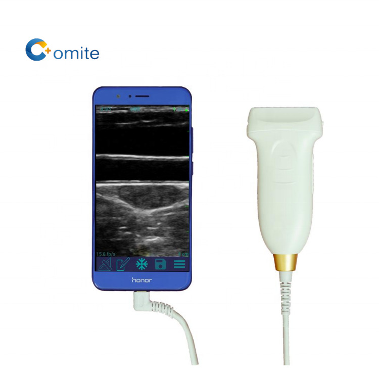 GYN ultrasound probe convex wifi usb wireless ultrasound probes for android