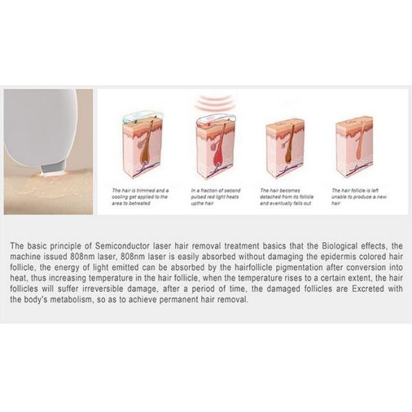 808nm Diode Laser Hair Removal Machine High Power, salon/clinic/ spa use