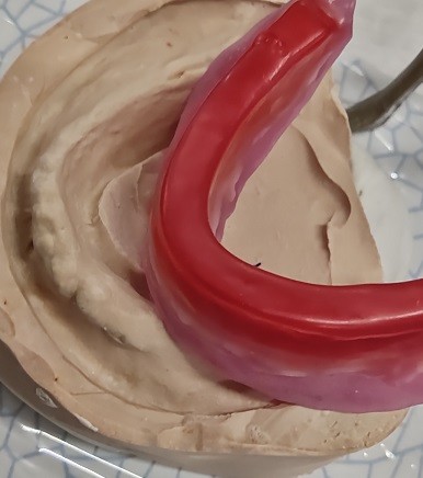 Bite Registration Dental Wax Rim