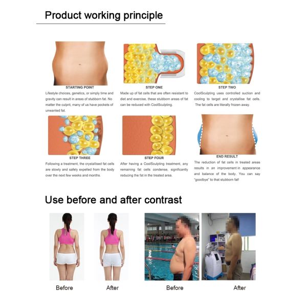 3 Хандпьесес Крйолиполысис уменьшая оборудование КР02 красоты потери веса машины