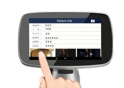 10 Times Magnification 16MP Ophthalmology Equipment