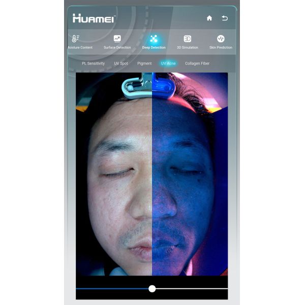 EU Plugs Portable Wifi Ipad Version 3d Skin Scanner Analyzer for Allergic Skin Test