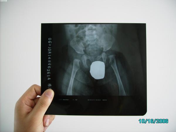 Low Fog Medical Imaging Film Dry X-ray For AGFA / Fuji / Kodak Printer