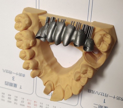 CAD CAM Design Dental 3D Print